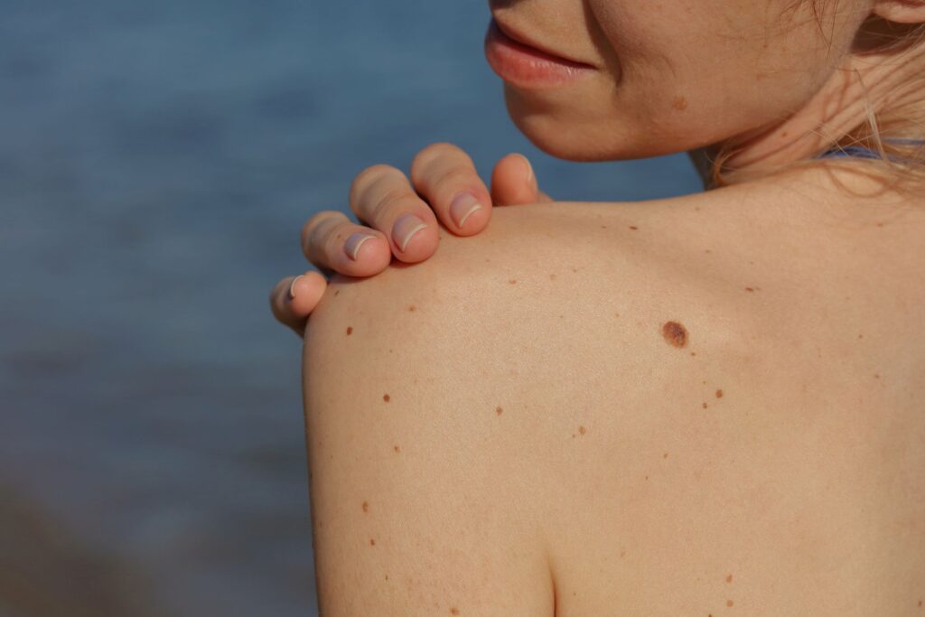 Cancer Symptoms In Tamil
